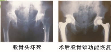 关节骨科介绍 关节骨科介绍