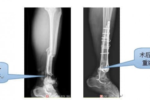 真实案例展示二