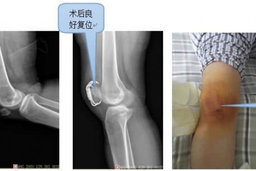 真实案例展示案例三