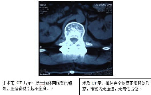 真实案例五 真实案例五