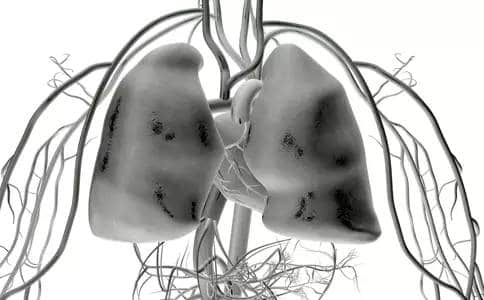 关于肺气肿的相关常识