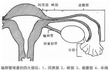 治疗不孕不育别着急,找准病因是关键! 治疗不孕不育别着急,找准病因是关键!